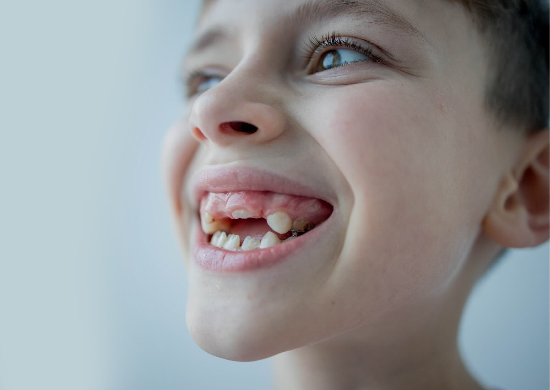 Smiling child with a missing front baby tooth, showing the natural process of kids losing their first tooth.